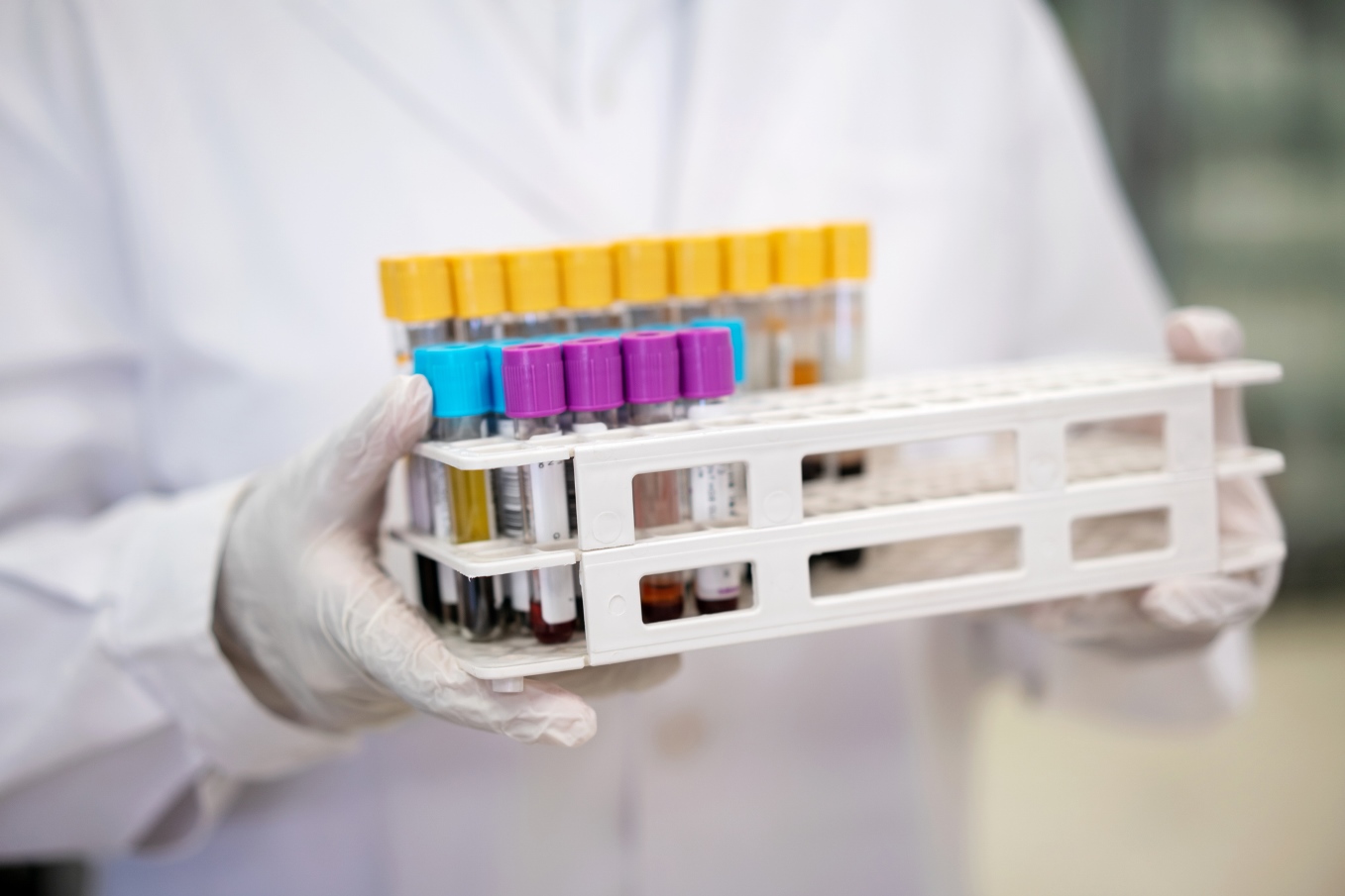 An assortment of samples. Woman scientist wearing protective gloves with test tube rack.